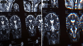 Digieffects Damage Destabilize Discount